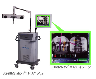 StealthStation(R)TRIA(TM)PLUS/FluoroNav(R)MASTイメージ